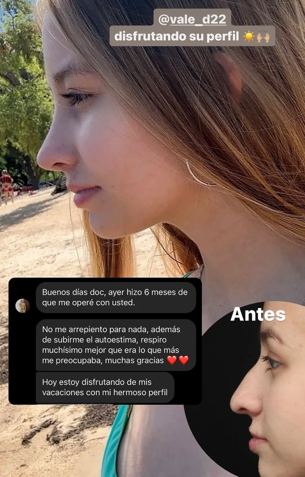 Testimonio de paciente en Instagram (11)
