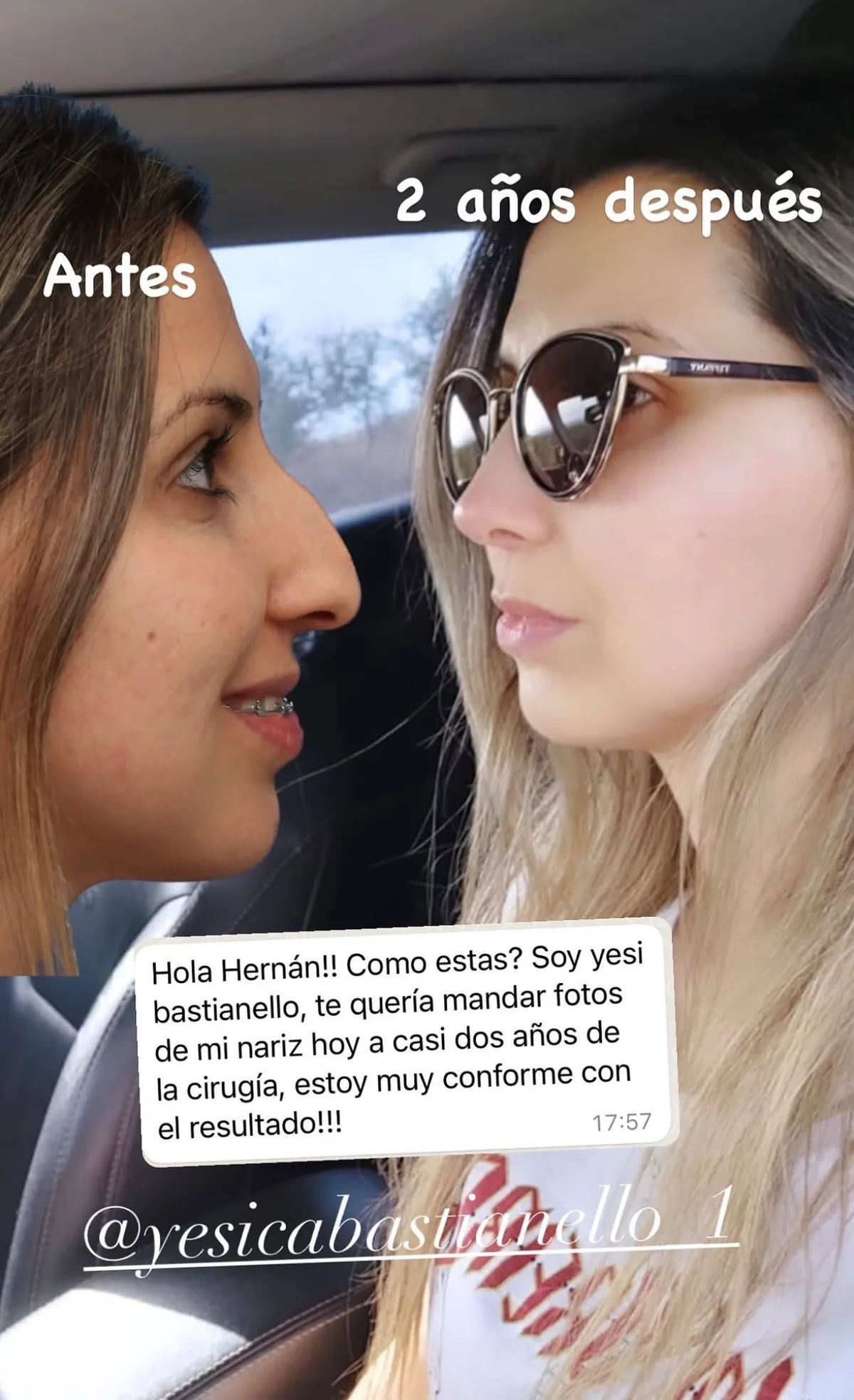 Testimonio de paciente en Instagram (17)