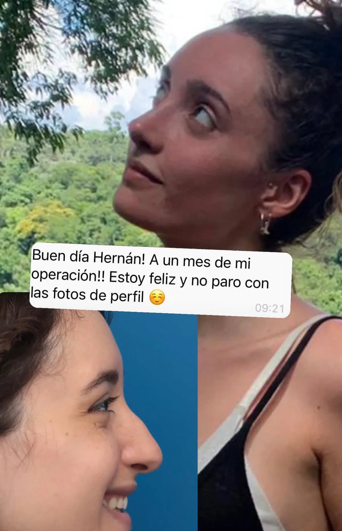 Testimonio de paciente en Instagram (20)
