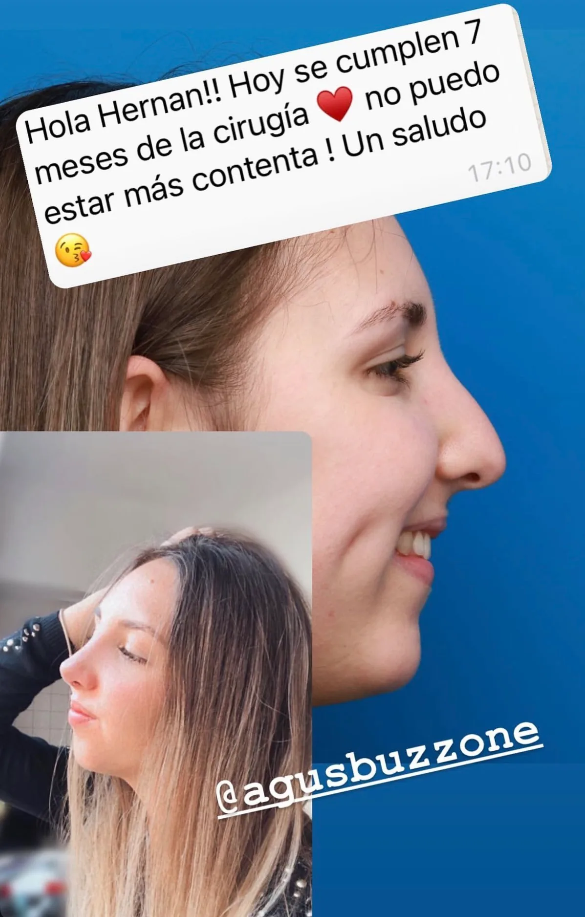 Testimonio de paciente en Instagram (22)