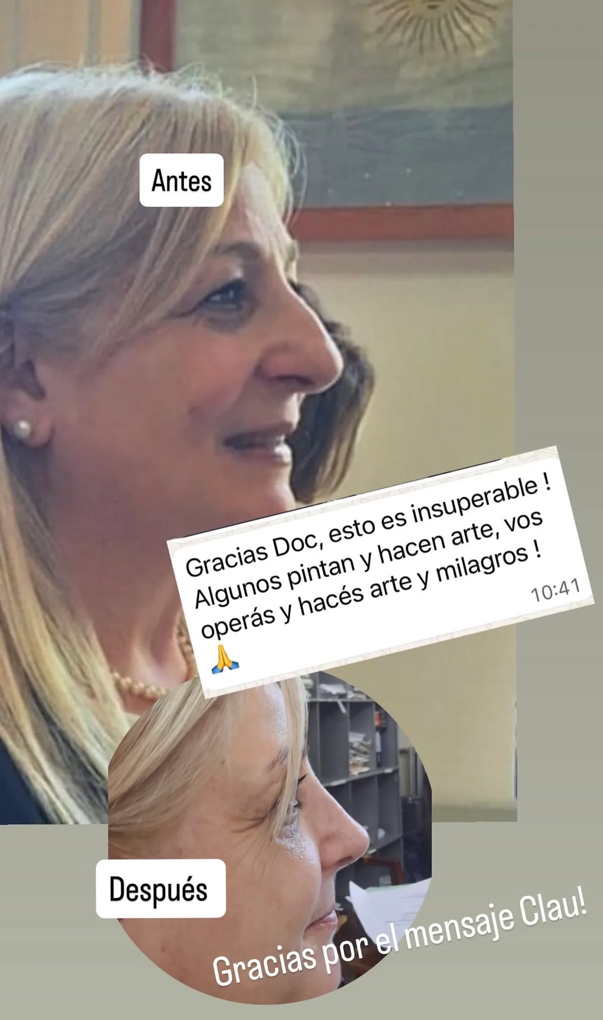 Testimonio de paciente en Instagram (24)