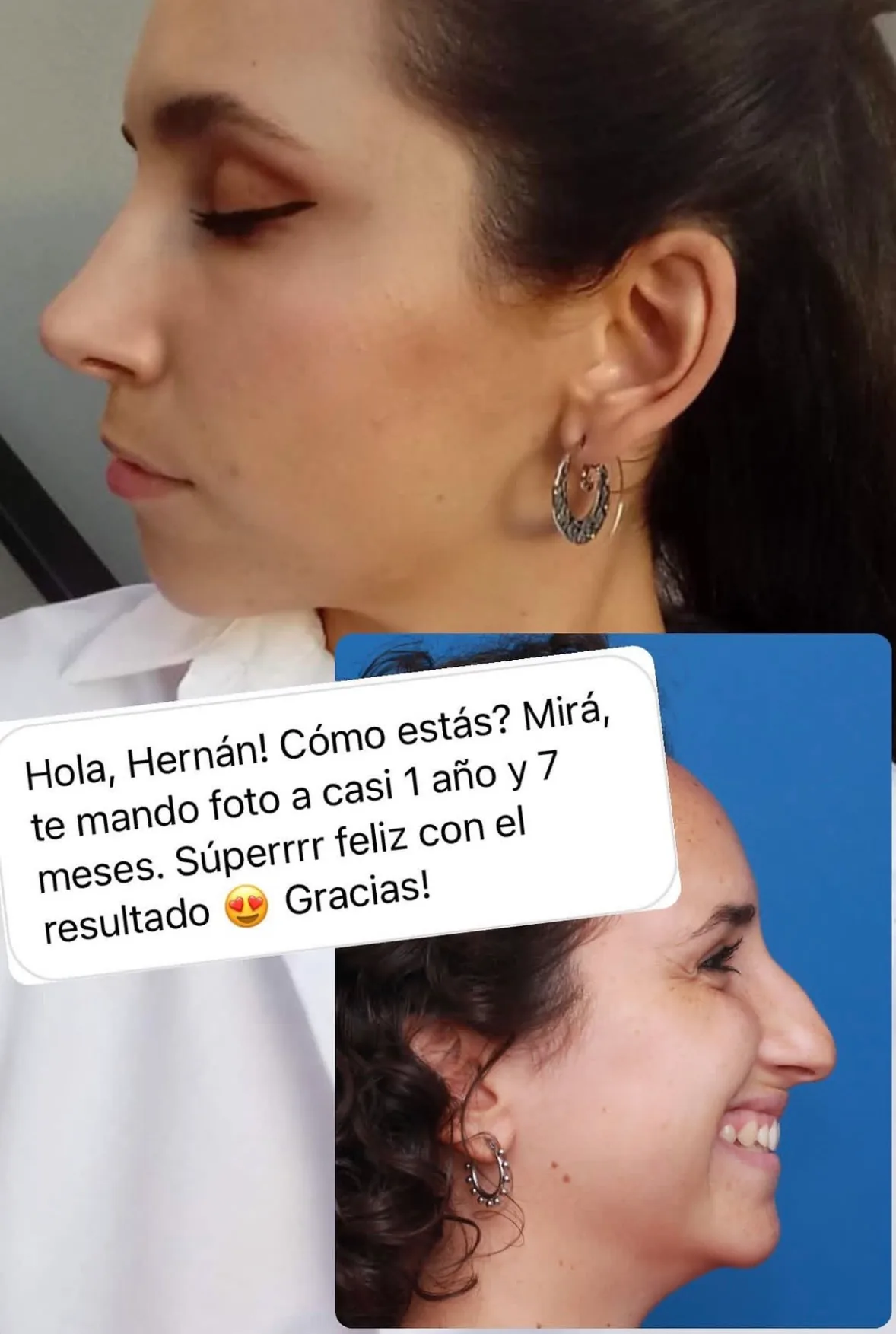 Testimonio de paciente en Instagram (25)
