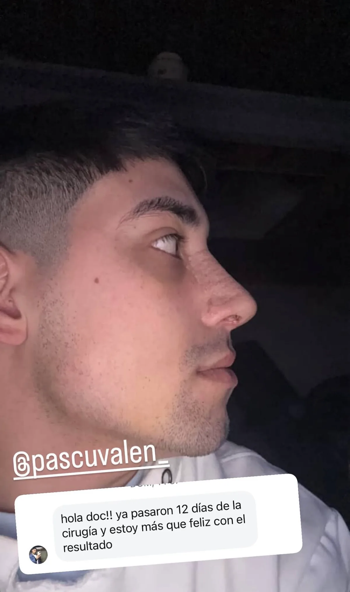 Testimonio de paciente en Instagram (26)