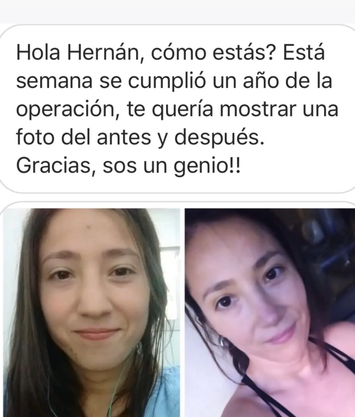 Testimonio de paciente en Instagram (28)